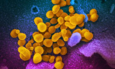 Photo of the Novel Coronavirus SARS-CoV-2, yellow, emerging from the surface of cells, blue/pink